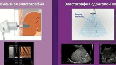 Photo of Эластография сдвиговой волной на УЗ-аппаратах: новейшие технологии в медицине